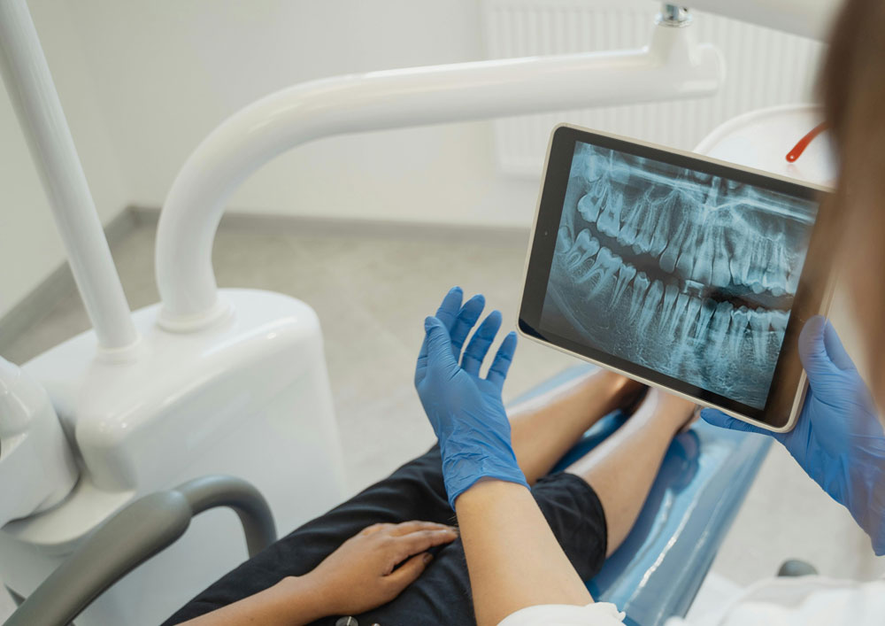 tecnologia avanzada implantes dentales en pedralba clinica dental vilamarxant