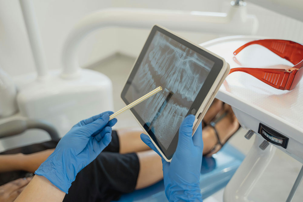 tecnologia avanzada mejor clinica de implantes dentales en vilamarxant clinica dental vilamarxant